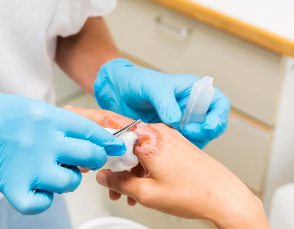 راهنمای گام به گام کندن پانسمان چسبیده به زخم