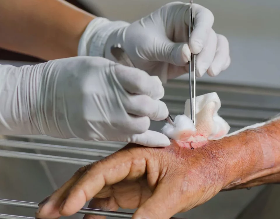 دبریدمان زخم